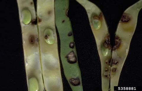 Anthracnose lesions on bean pods